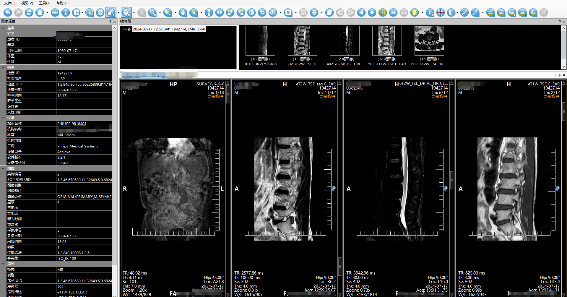 DICOM Viewer · CS医学影像查看器