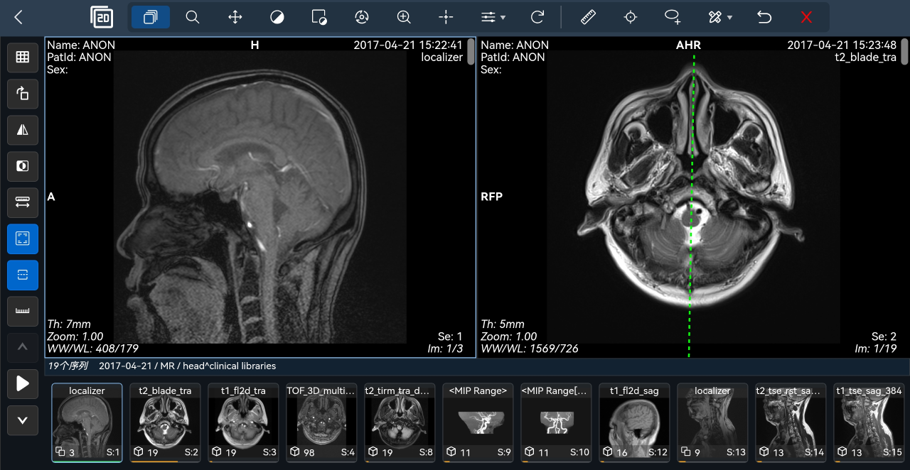 DCMViewer · BS医学影像浏览器