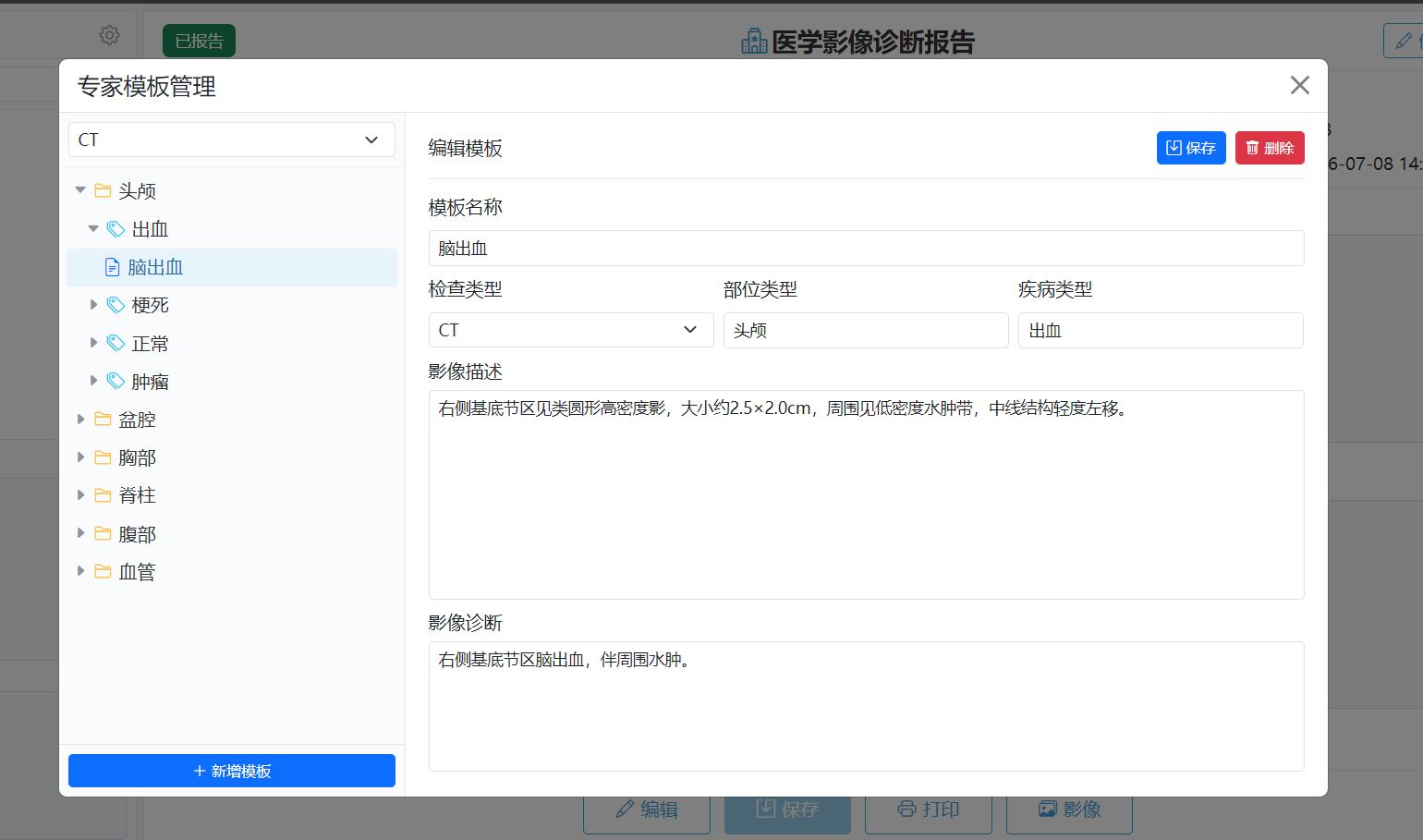 模版管理